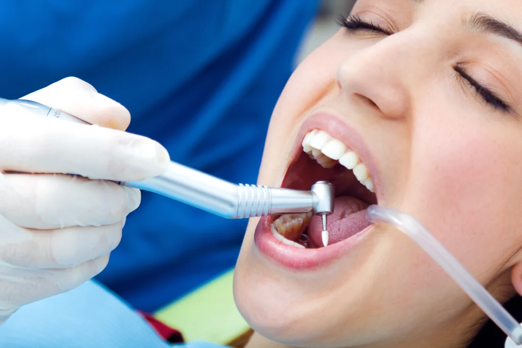 Root Canal Treatment in India