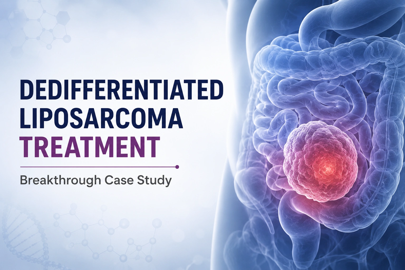 Read more about the article Rare Peritoneal Dedifferentiated Liposarcoma Treatment: Breakthrough Case Study by Dr. Manish Singhal