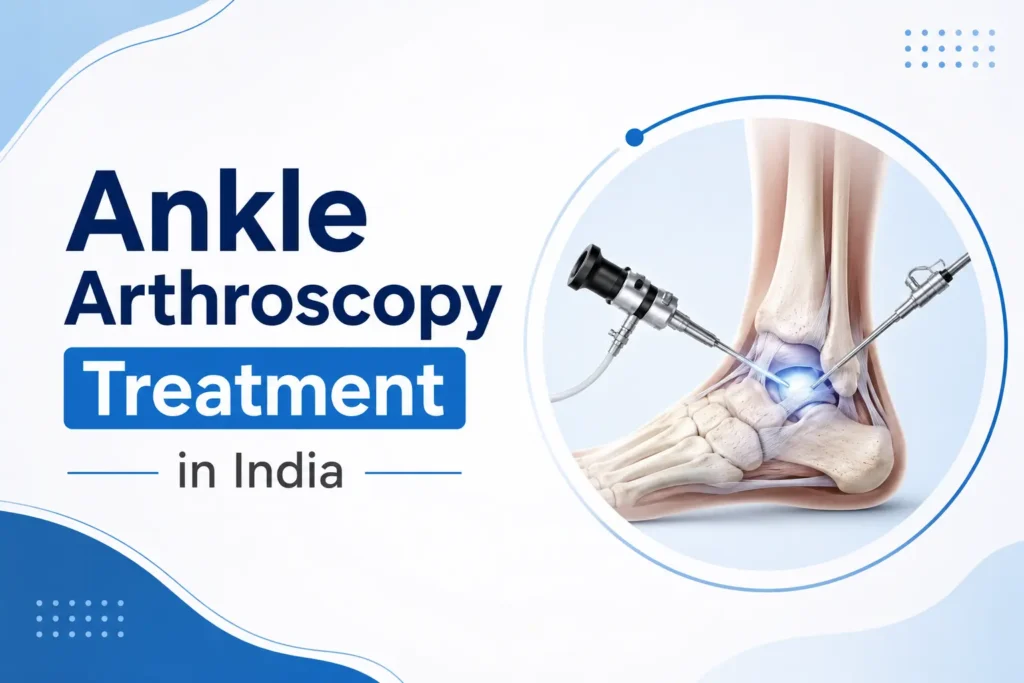 Ankle Arthroscopy Treatment in India
