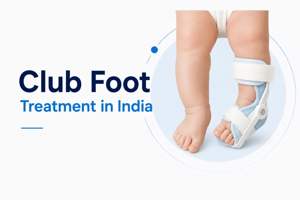 Club Foot Treatment in India