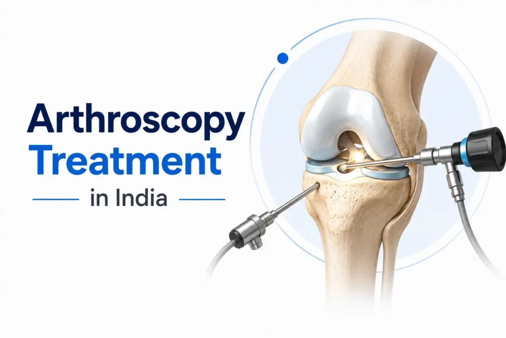 Arthroscopy Treatment in India