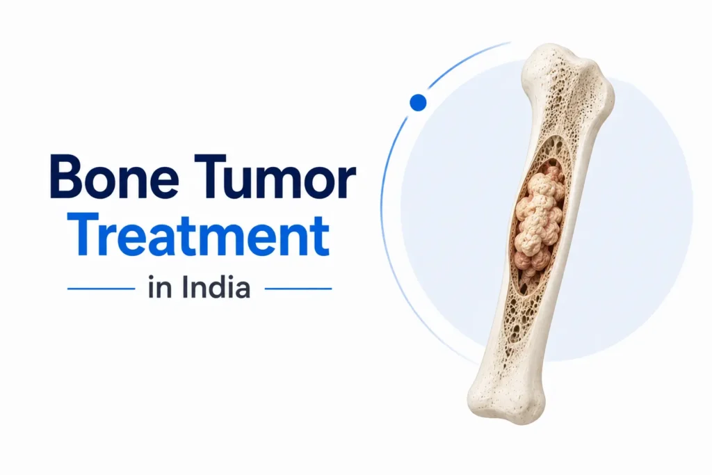 Bone Tumor Treatment in India