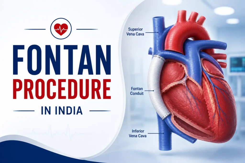 Fontan Procedure in India