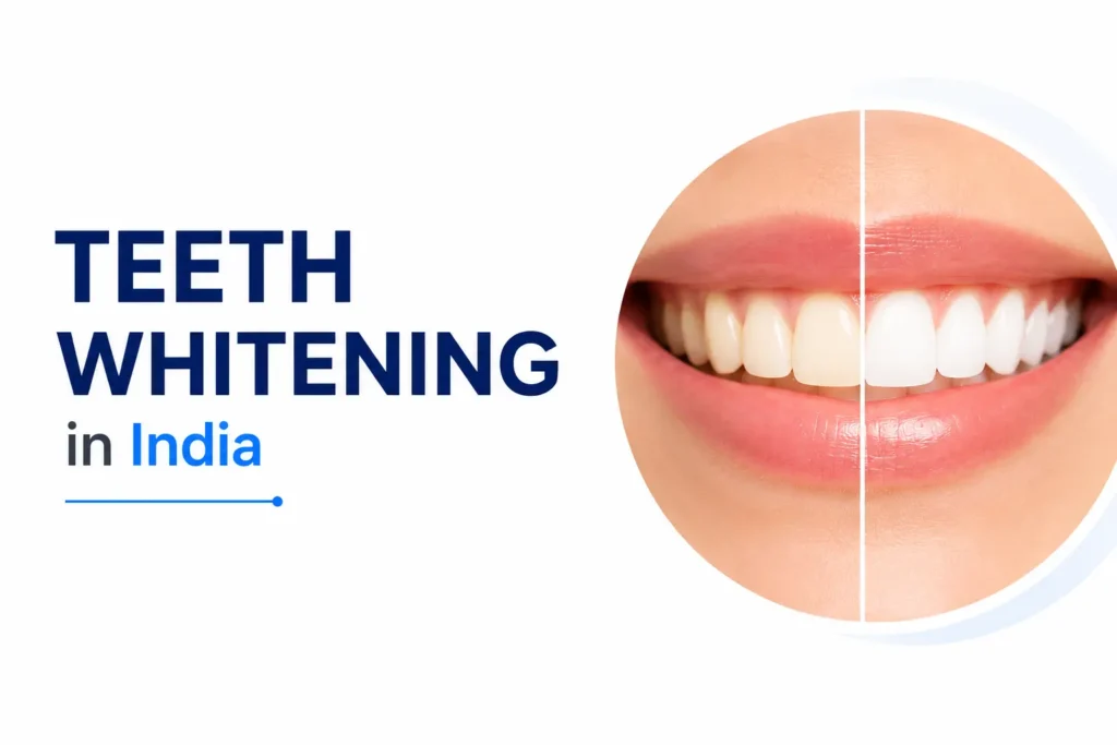 Teeth Whitening in India